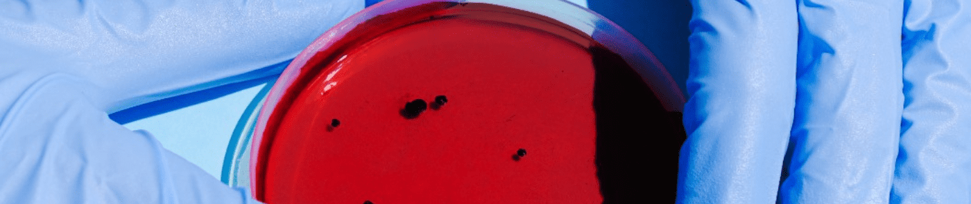 Medical Device Sterilization